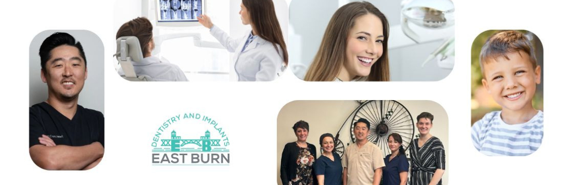 East Burn Dentistry and Implants Cover Image
