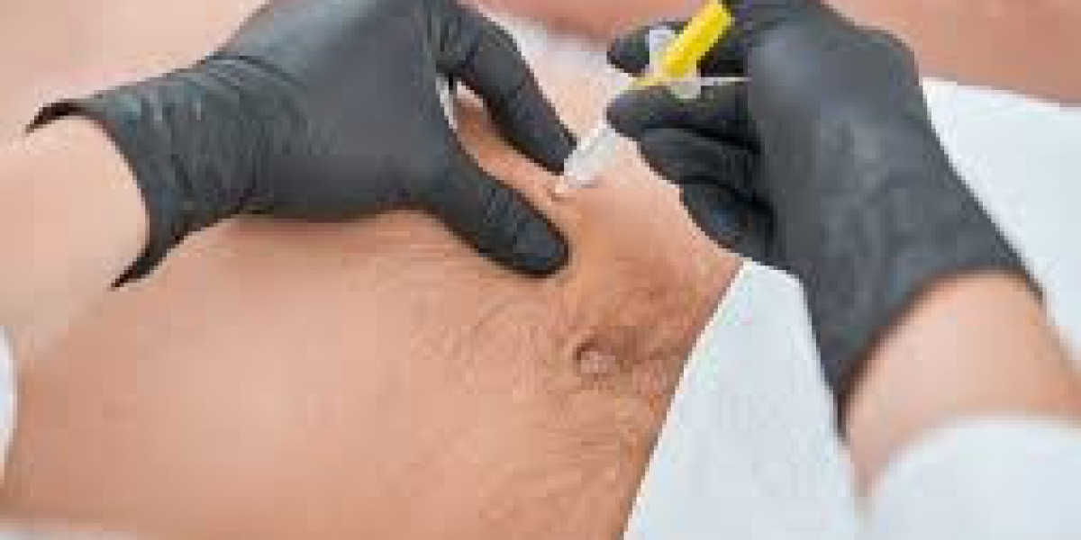 Fat Melting Injection in Dubai: Achieve a Slim and Sculpted Body Safely