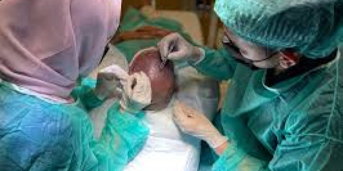 Understanding Hair Transplant in Dubai: Process, Benefits, and Healing