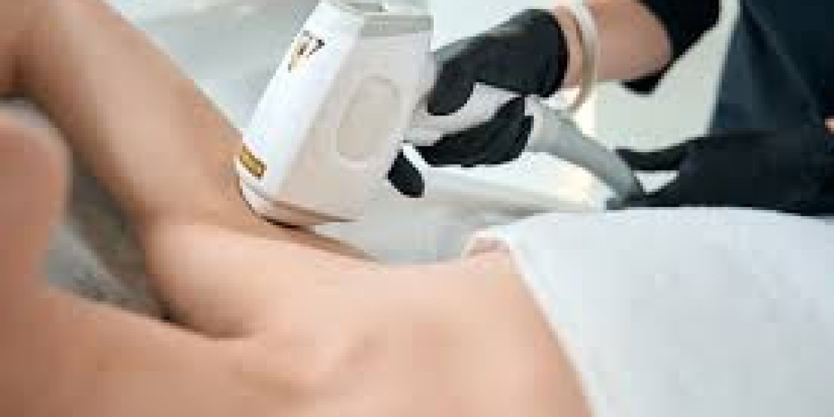 The Ultimate Benefits of Laser Hair Removal in Dubai