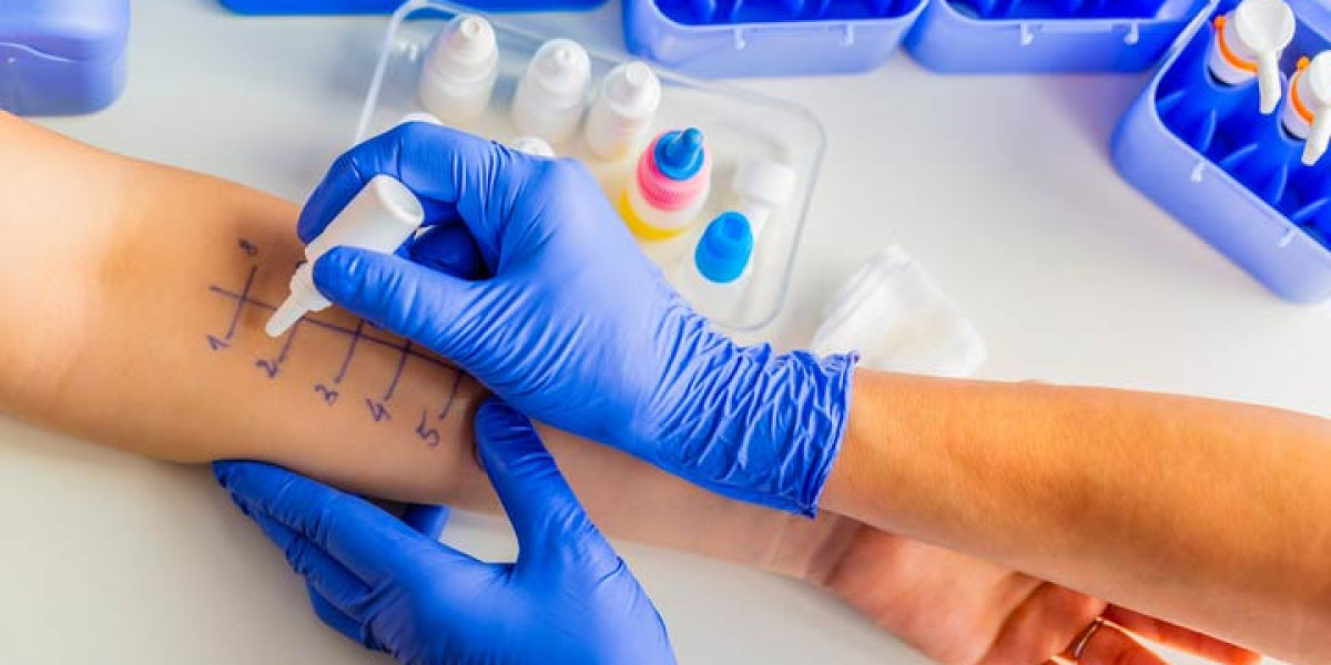 Allergy Testing Kit Manufacturing Plant 2025: Project Report, Business Plan, Raw Materials, and Cost Analysis
