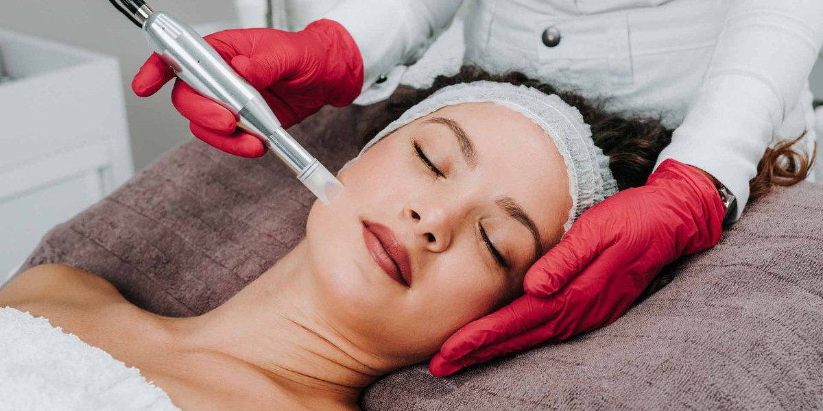 Morpheus8 Treatment: A Smart Choice for Aging Skin