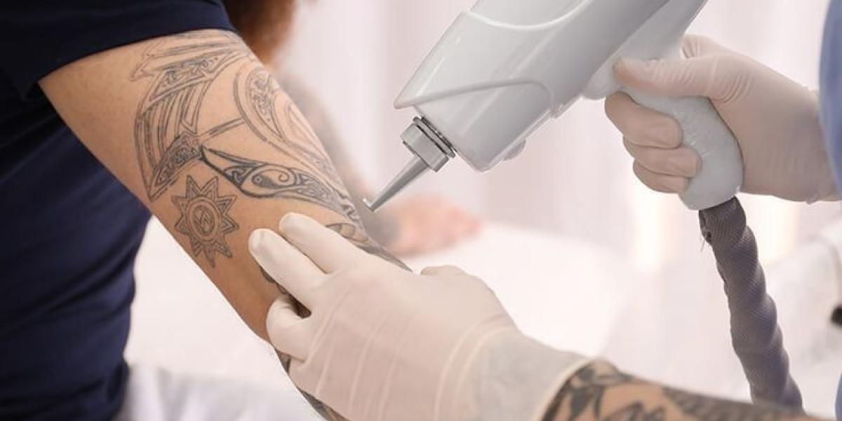 Tattoo Removal in Dubai: Step-by-Step Removal Process