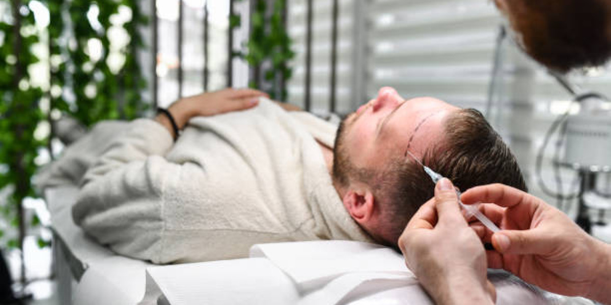 Hair Transplant in Dubai: Everything You Need to Know Before Your Procedure