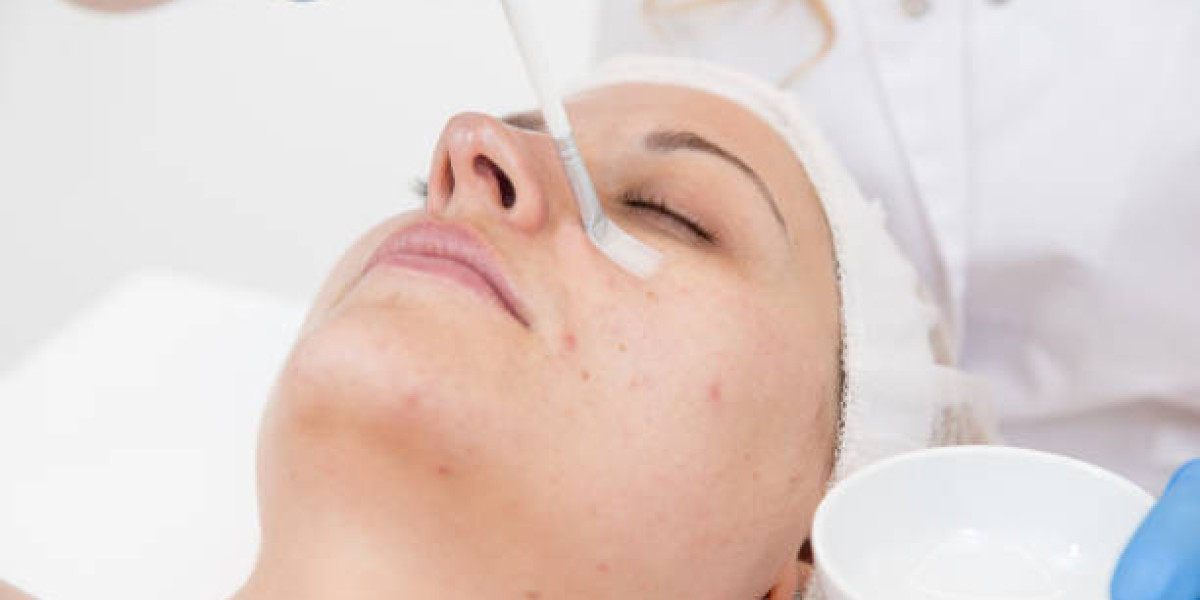 The Science Behind Chemical Peels in Dubai