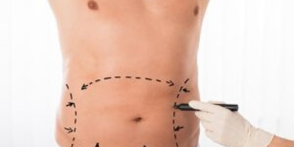 Mini Abdominoplasty in Dubai: How Long Do the Results Really Last?