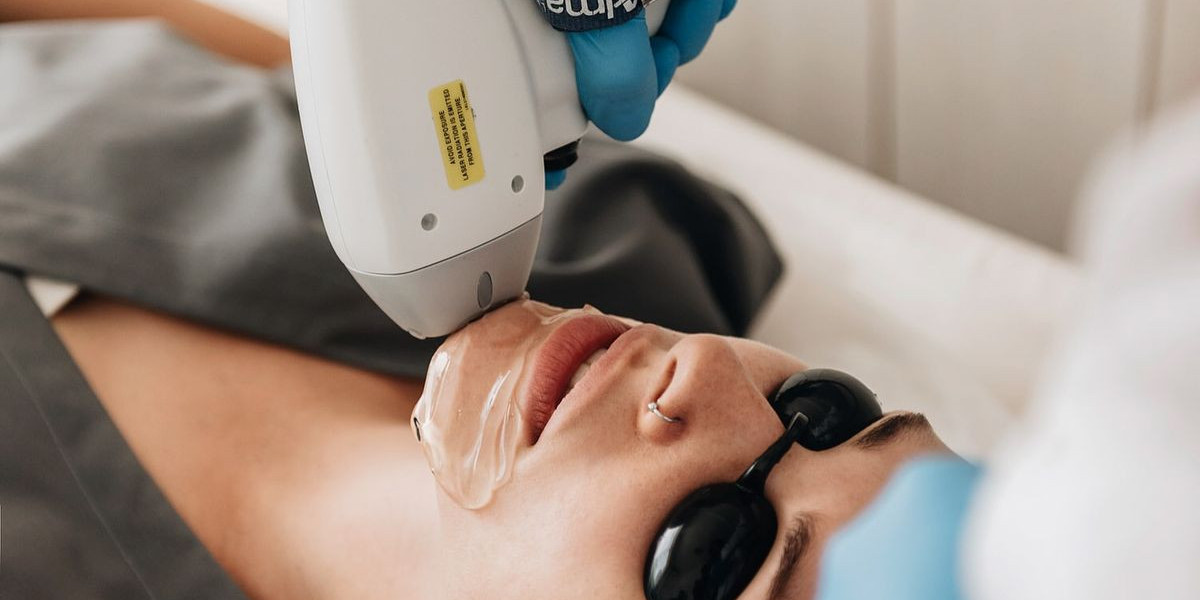 Laser Hair Removal in Dubai for Dark Skin Tones: What You Should Know