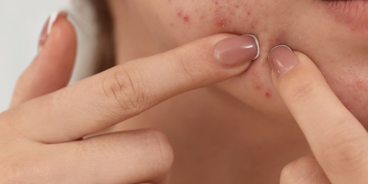 Pigmentation Treatment in Riyadh for a Smooth and Even Finish