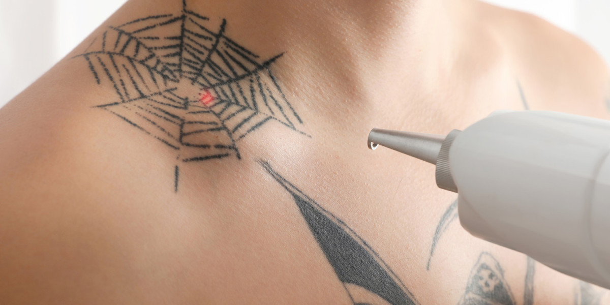 Can Laser Tattoo Removal Interfere With Future Skin Treatments in Dubai?