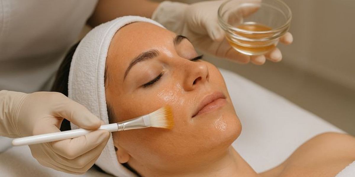 Chemical Peels : Reveal Your Skin’s Natural Glow