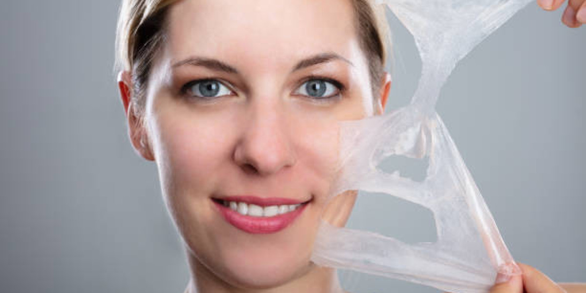 Chemical Peels in Dubai: The Ultimate Guide to Glowing Skin
