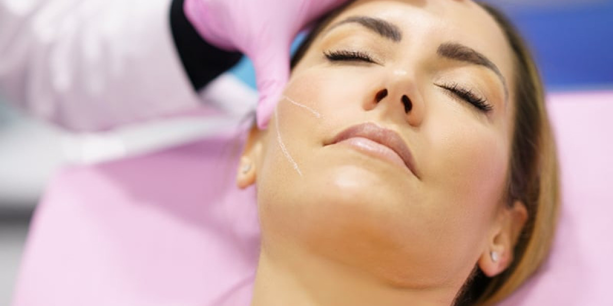 The Ultimate Guide to Non-Surgical Thread Lifts