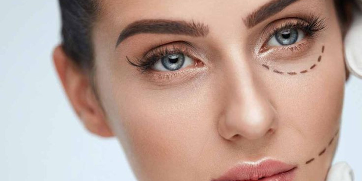 Eyelid Surgery and Scarring: Minimizing Risks