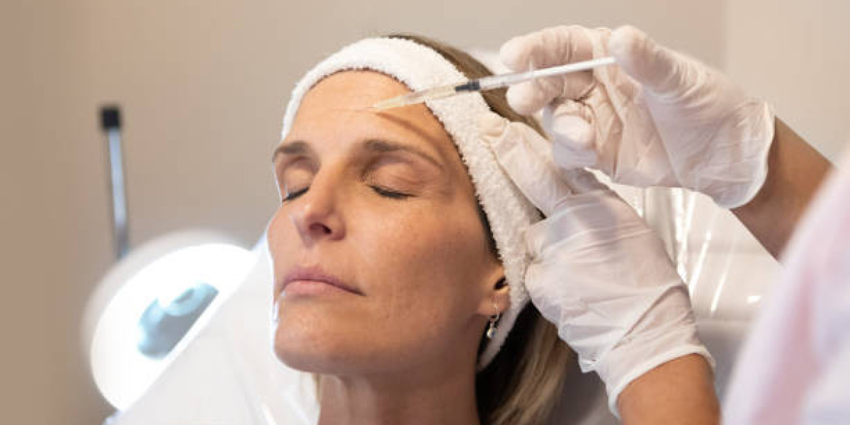 How Long Do the Results of Botox Typically Last? A Timeline Guide