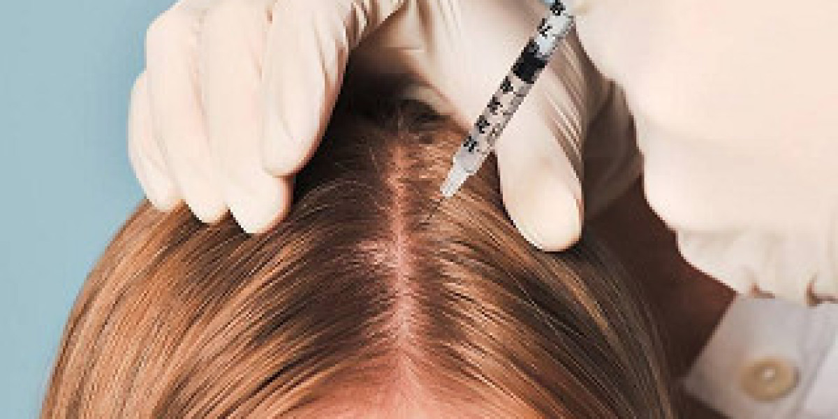 PRP Hair Treatment in Dubai: Boost Scalp Health for Fuller Hair