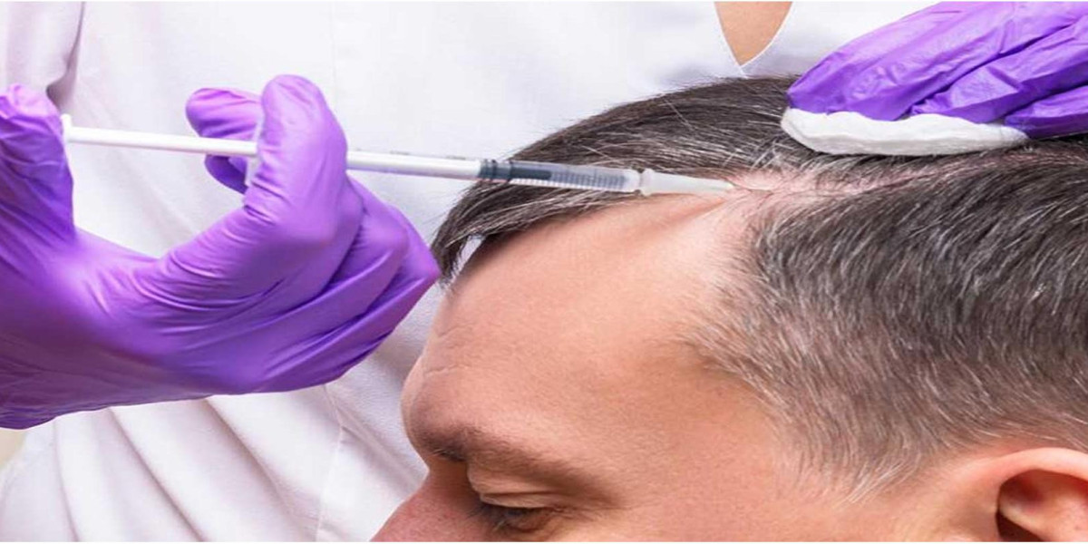 Expert Specialists for PRP Hair Treatment in Riyadh