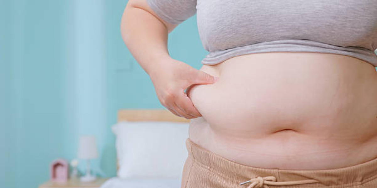 Liposuction Surgery in Dubai: Transform Your Body Safely