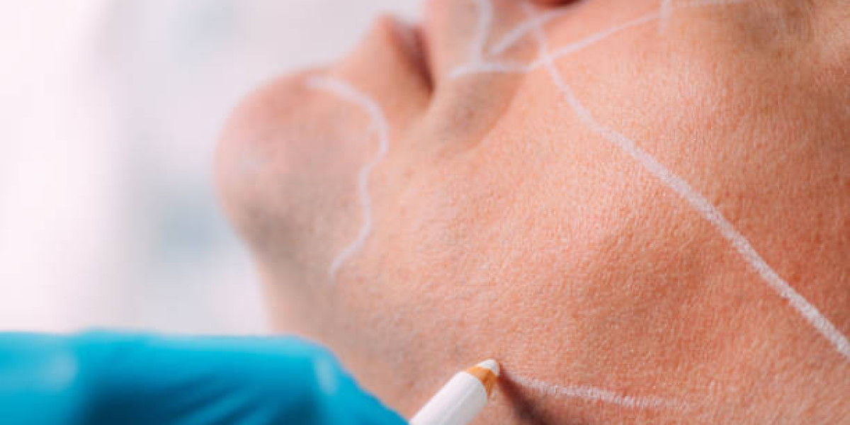 Jawline Surgery in Dubai: Natural Results That Last Years