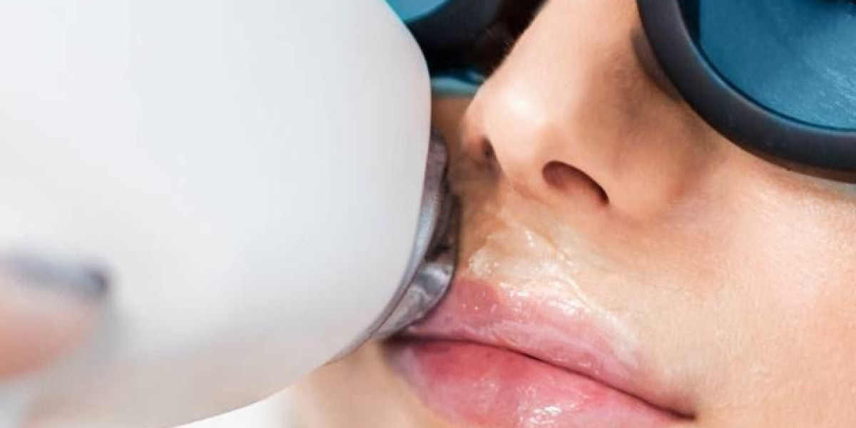 How Laser Hair Removal Can Boost Your Confidence