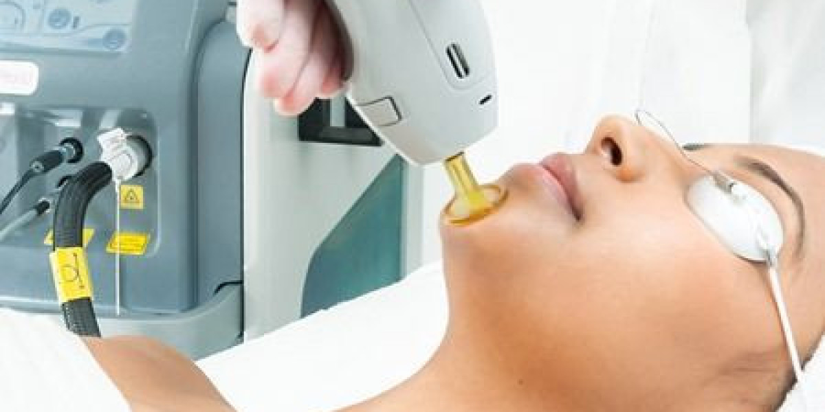 Laser Hair Removal in Dubai for Men: Everything You Need to Know