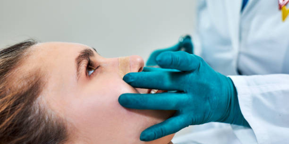 Rhinoplasty in Dubai: Transform Your Look with Expert Care