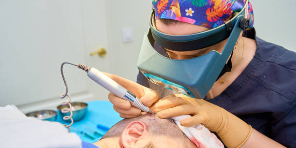 Hair Transplant Cost in Dubai: What You Need to Know Before Booking