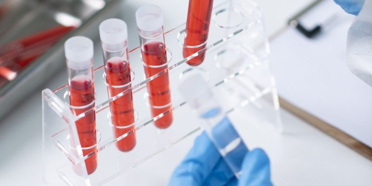 The Importance of Regular STD Test in Dubai for Young Adults