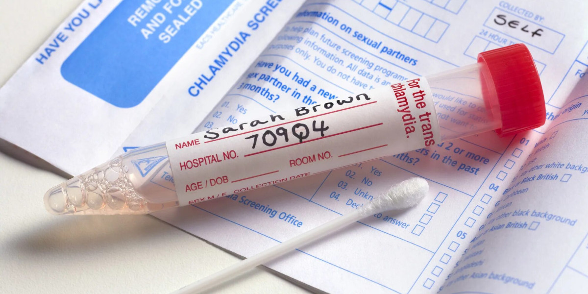 Chlamydia Test Explained: How It Works and Why It Matters