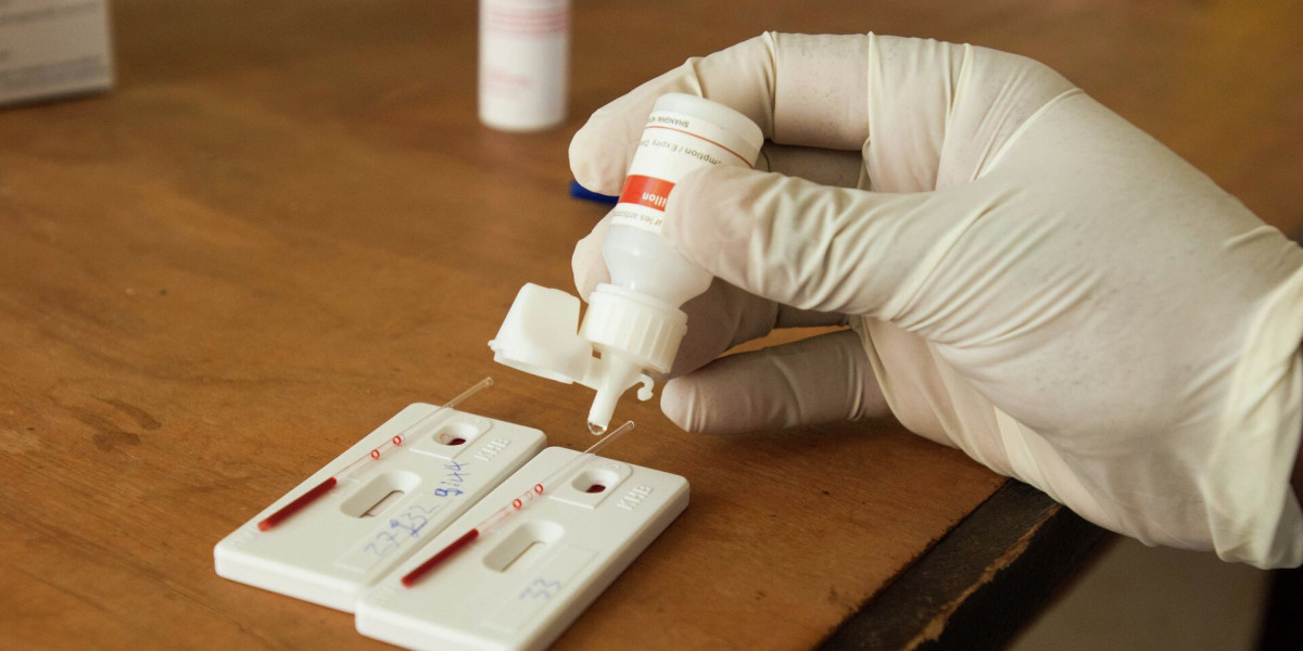 Top Reasons People Choose to Take an HIV Test