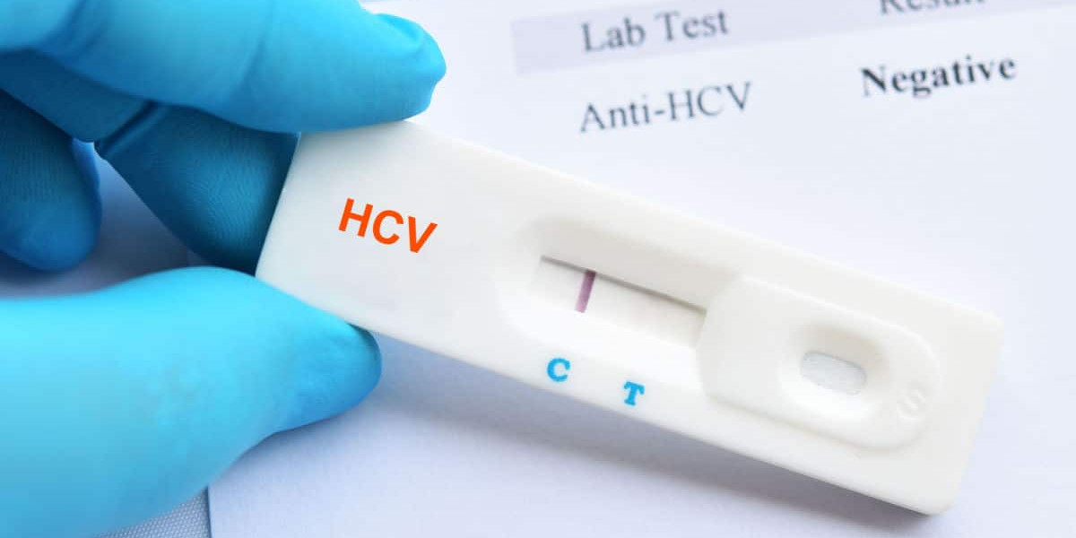 When Should You Take an HIV Test? Key Signs and Timelines Explained
