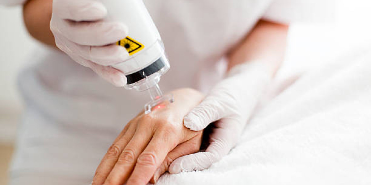 Laser Hair Removal in Dubai: A Complete Guide for Smooth Skin