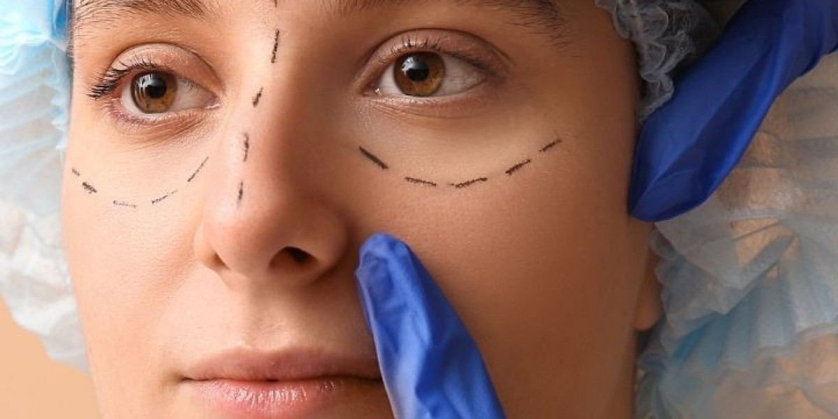 Safety, Precision, and Results with the Best Blepharoplasty Surgeon in Dubai