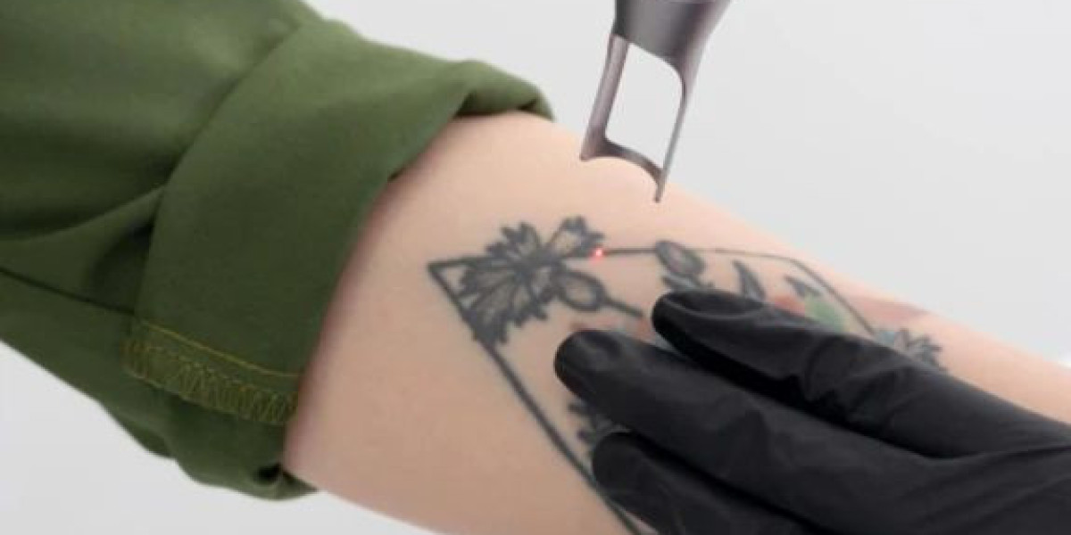 Tattoo Removal in Dubai: Separating Myths from Medical Facts
