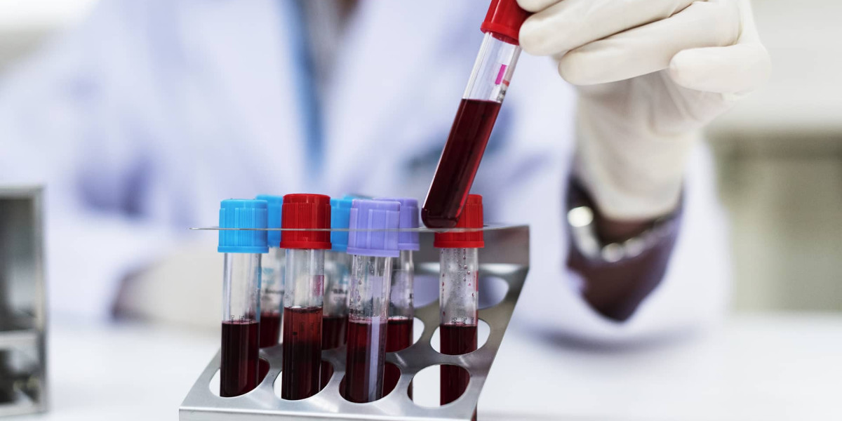 What Age Groups Should Get Tested for Chlamydia?