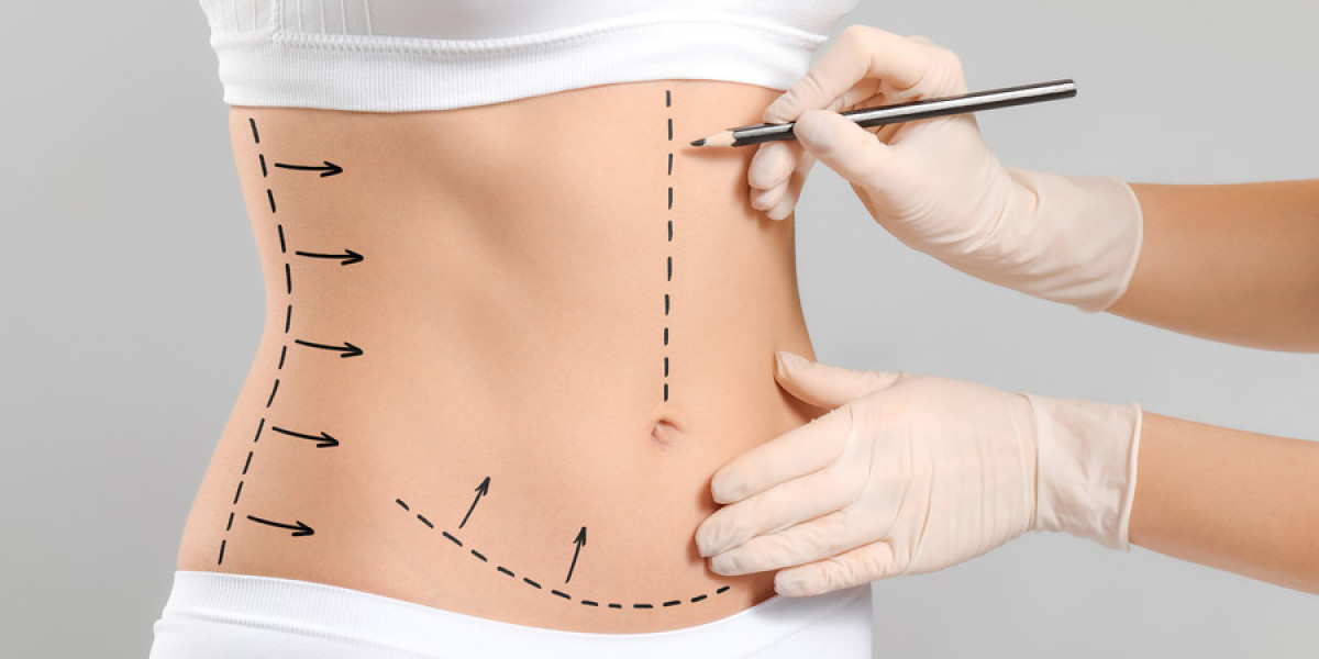 Different types of liposuction techniques available in Riyadh