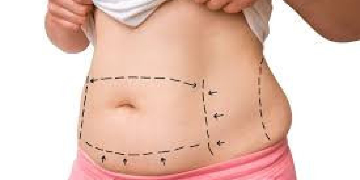 What should I pack for recovery after tummy tuck surgery in Dubai?