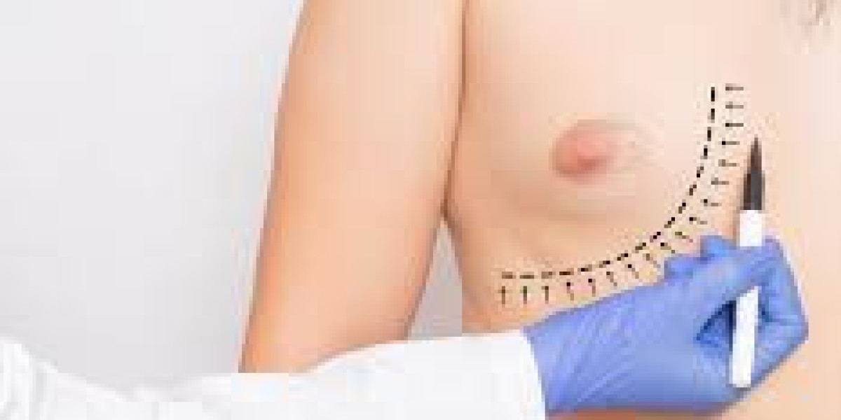 Gynaecomastia Surgery in Dubai: Post-Surgery Skincare and Scar Management