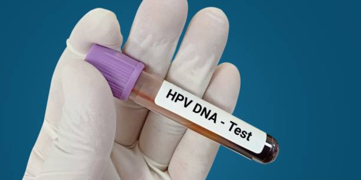 HPV Test Procedure: What to Expect Before, During, and After