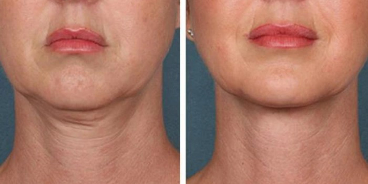 Best Plastic Surgeons in Dubai for Premium PRP Treatment