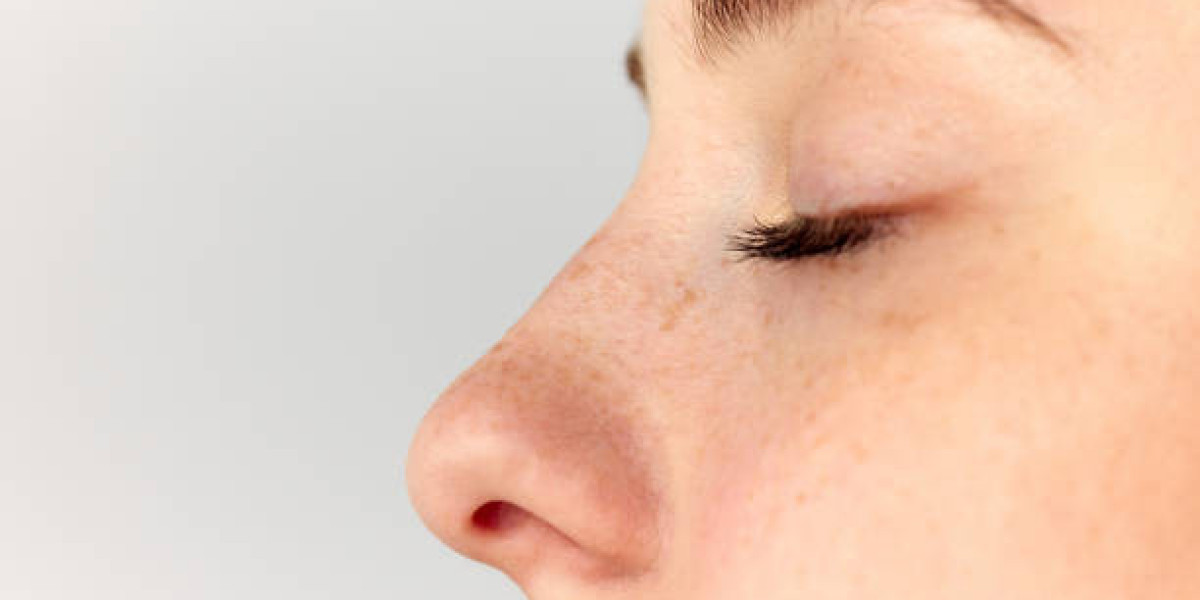 Rhinoplasty in Dubai: Transform Your Nose with Expert Care