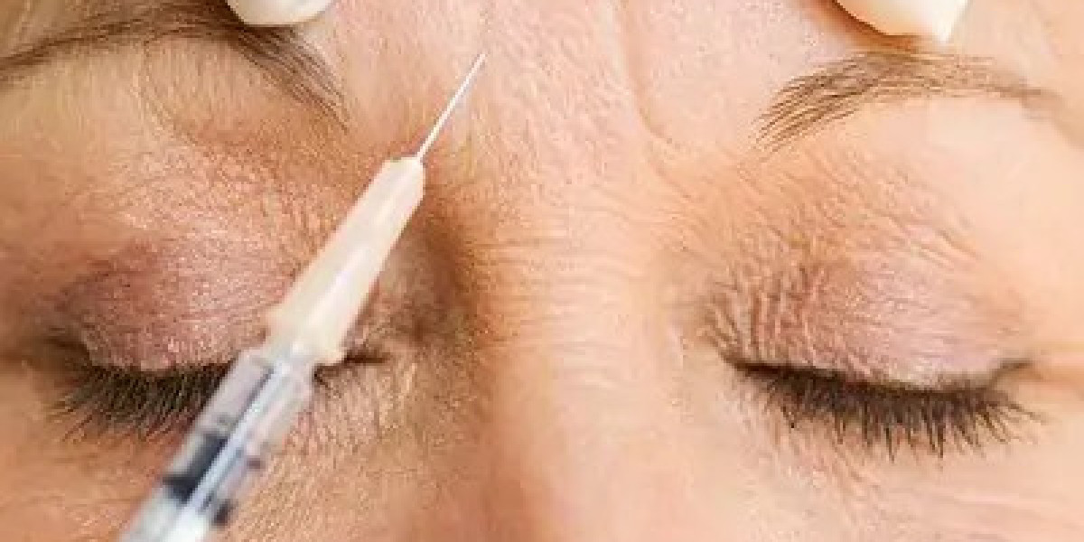 Can Xeomin Smooth Forehead Wrinkles and Frown Lines?