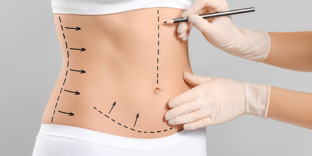 The Rise of Lipo 360: Total Midsection Transformation in Riyadh
