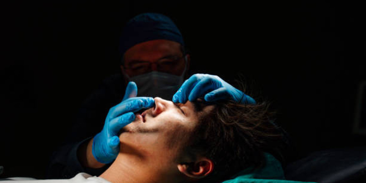 Rhinoplasty in Dubai: Everything You Need to Know Before Your Surgery