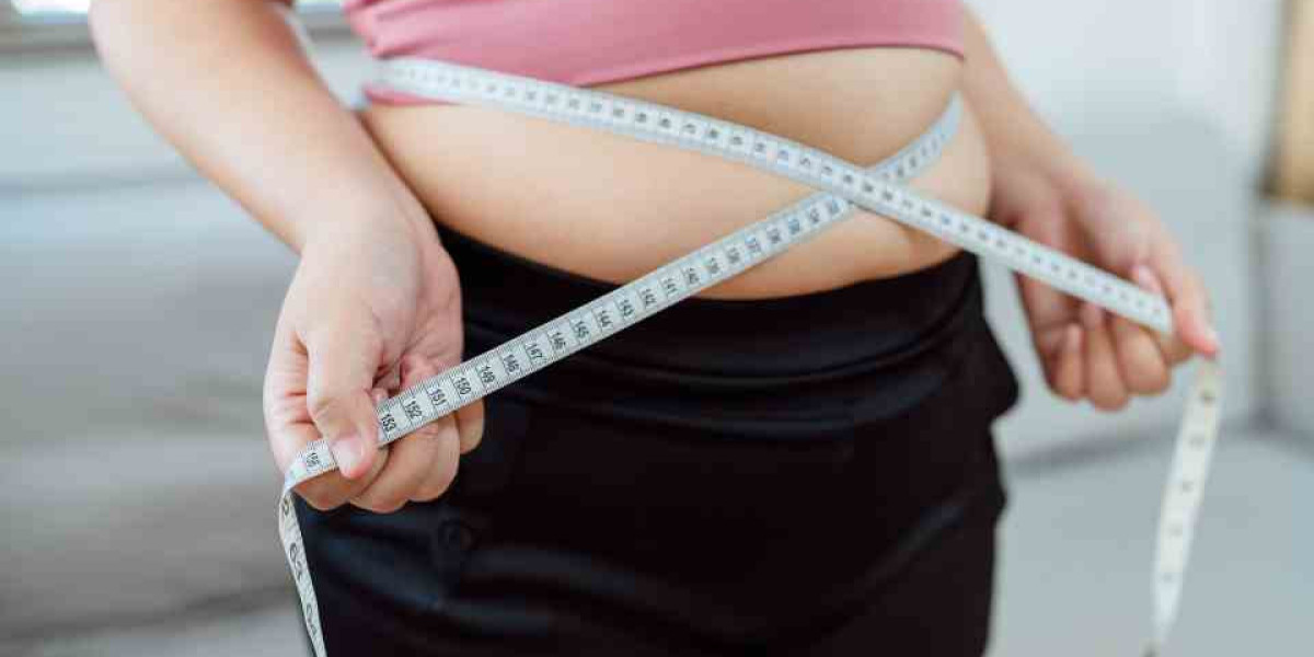 How Effective is Gastric Plication for Long-term Weight Loss?