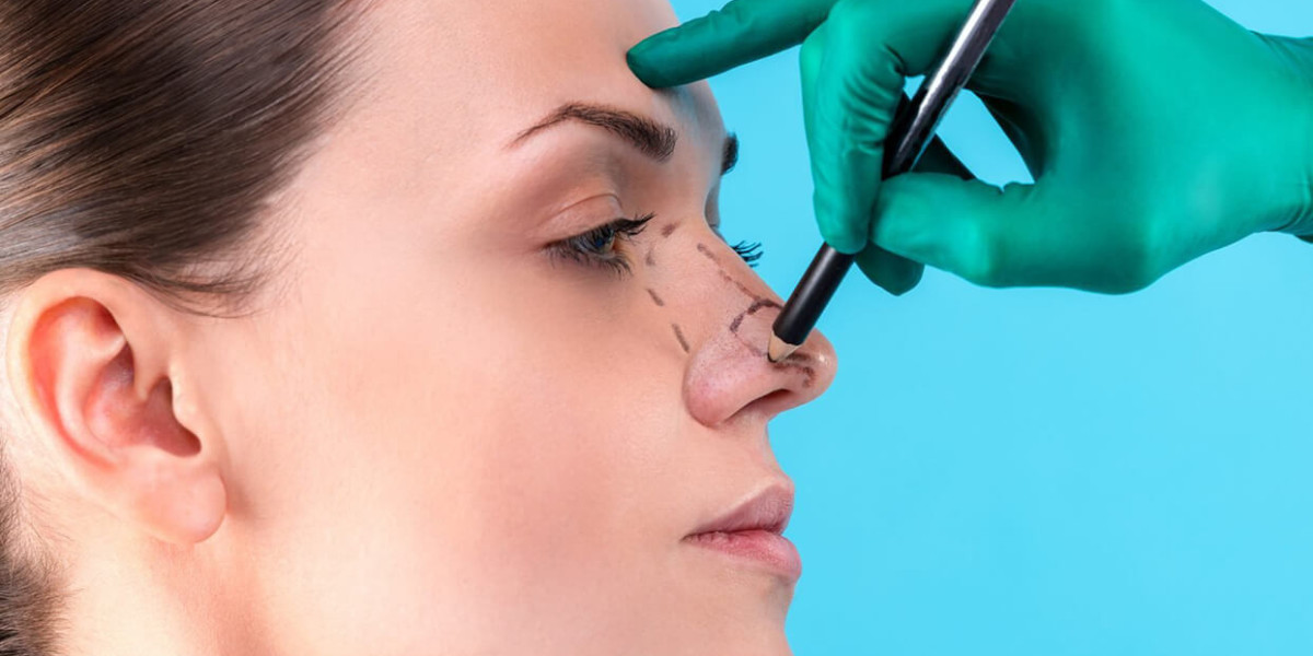 Benefits of choosing rhinoplasty in Riyadh