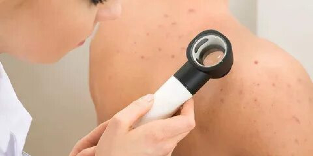 Safe Methods for Treating Eczema at Dermatech Polyclinic