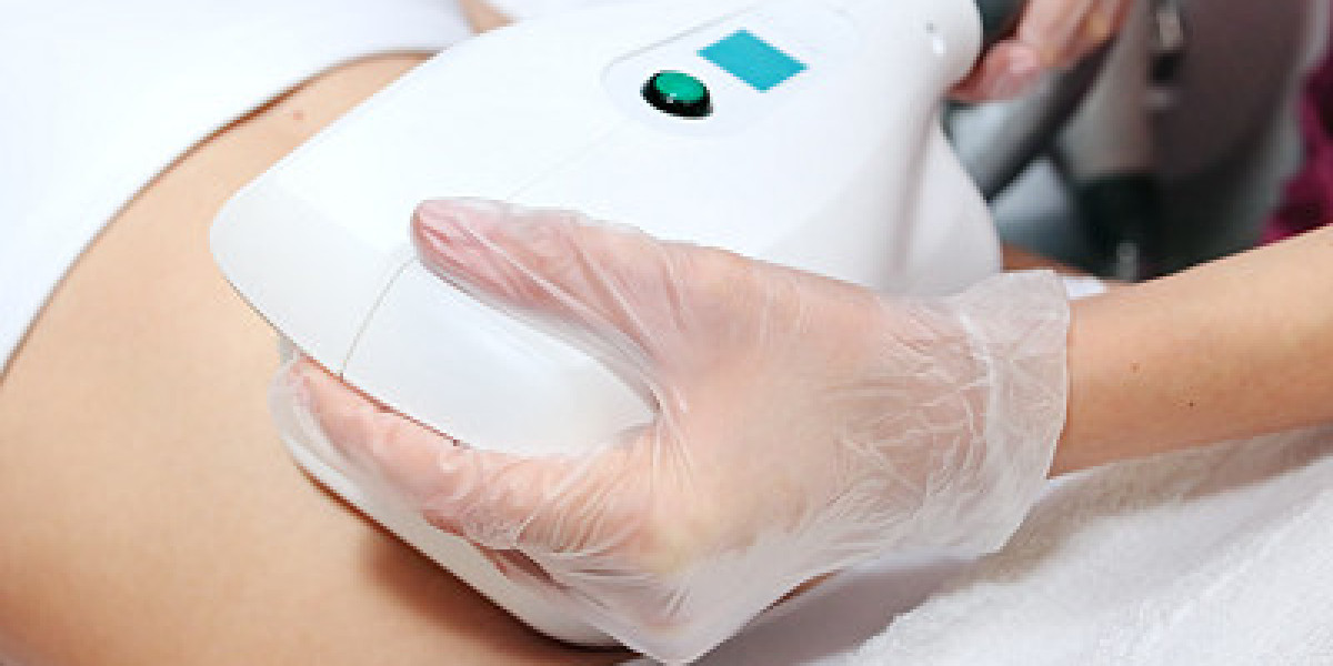 CoolSculpting Cost Secrets for Effortless Confidence Boost