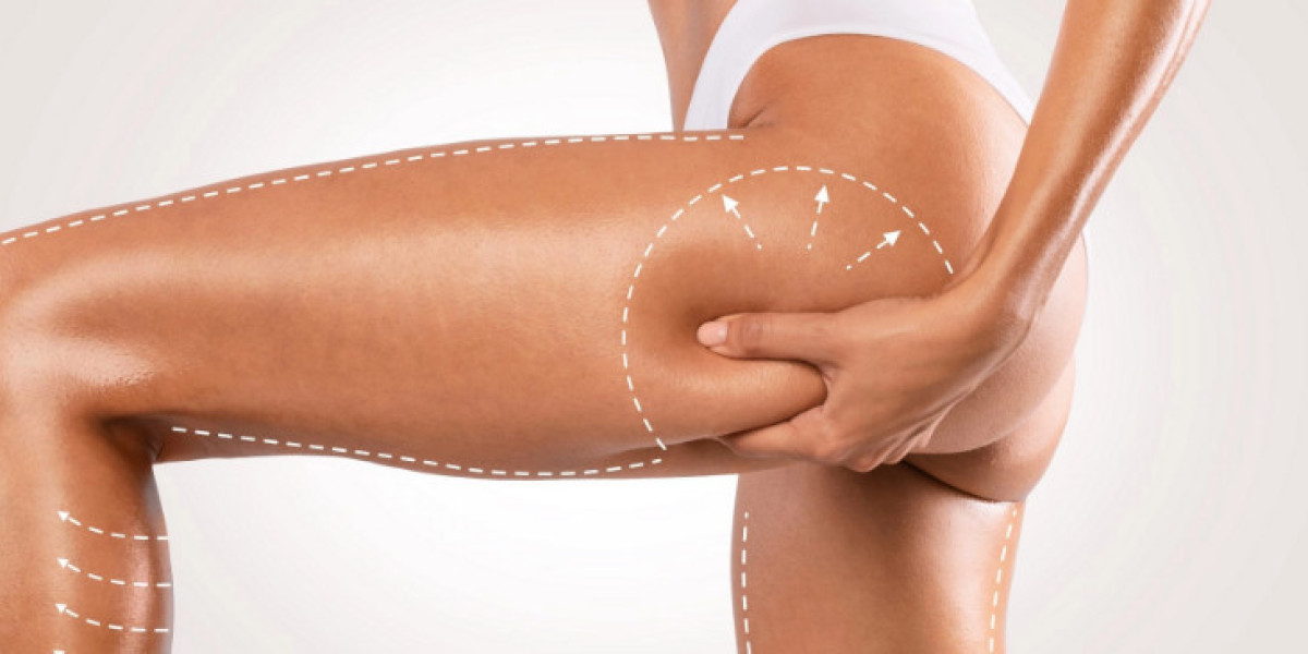 Thigh Lift Surgery in Riyadh: Understanding the Costs and Results