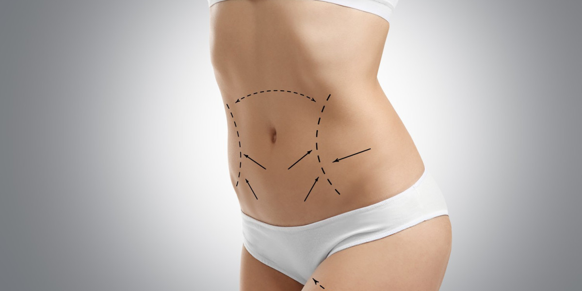 Liposuction in Riyadh Demystified: Steps to a Leaner You Now