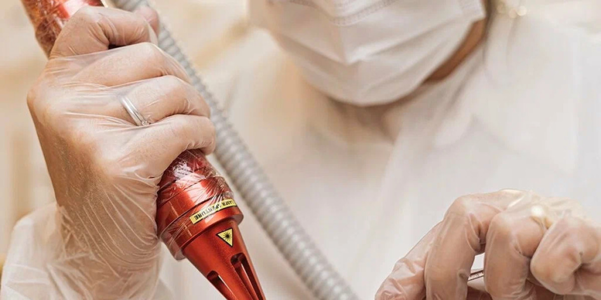 Laser Hair Removal Cost in Dubai and Why It Is Trending